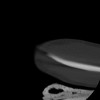 SPORK, NICO - 22.03.1976 - 02.08.2022 - CT obere Extremität - 17:59:38